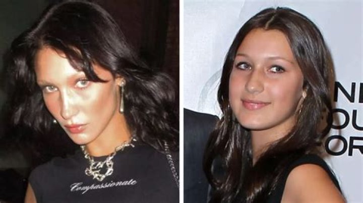 Bella Hadid Says She Regrets Getting a Nose Job at 14 | Teen Vogue